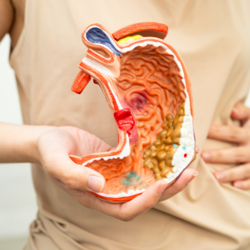 Digestive Health Treatment
